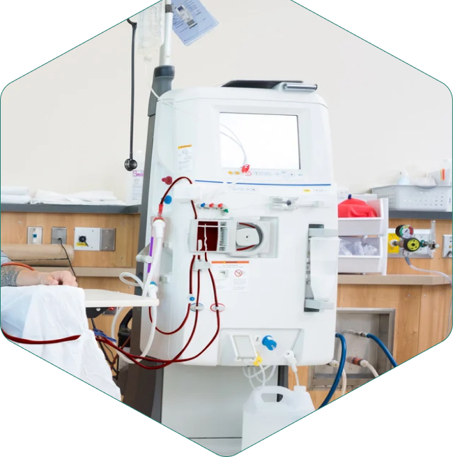 Dialysis Equipment